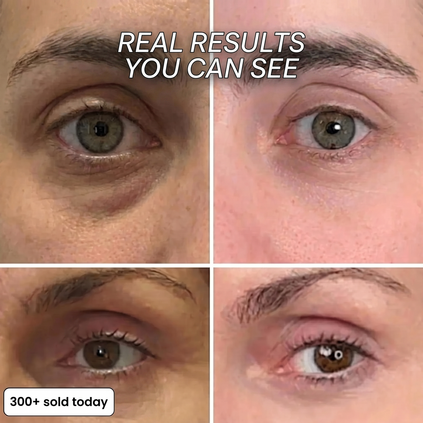 Bio-Collagen PDRN Plumping Stick