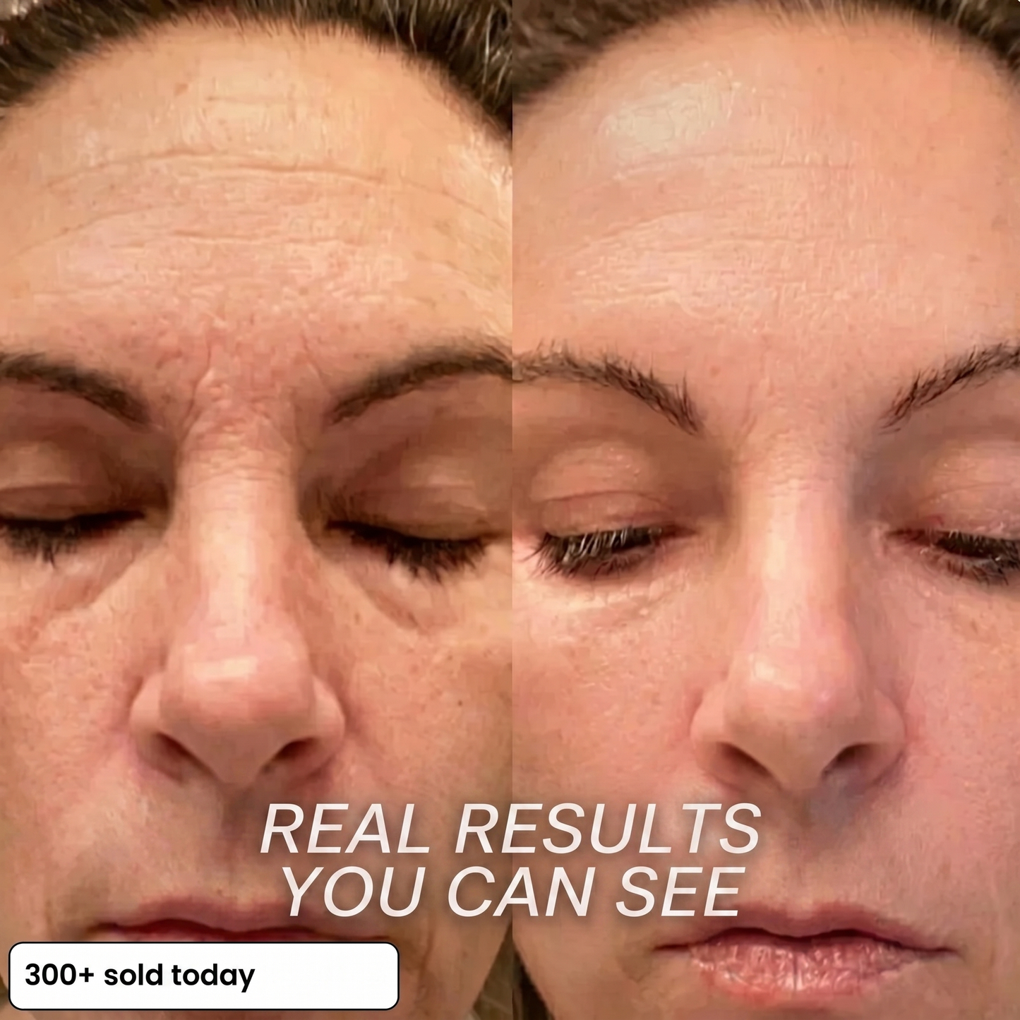 Bio-Collagen PDRN Plumping Stick
