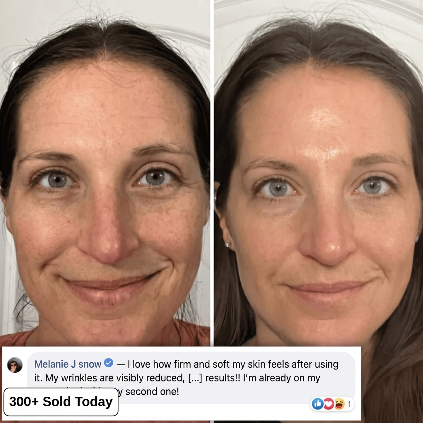 Bio-Collagen PDRN Plumping Stick