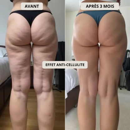 Legging 3D Anti-Cellulite